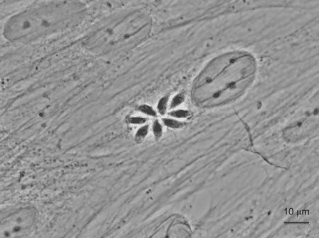 Image microscopique d’une cellule humaine infectée par Toxoplasma gondii avec la formation d’une rosette de 8 parasites. Crédit CNRS/Inserm