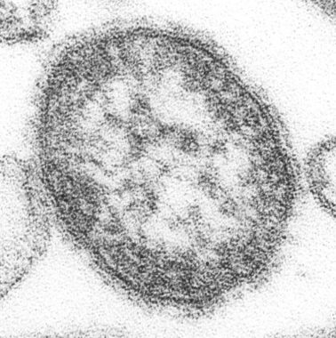Virus de la rougeole au microscope électronique. DR