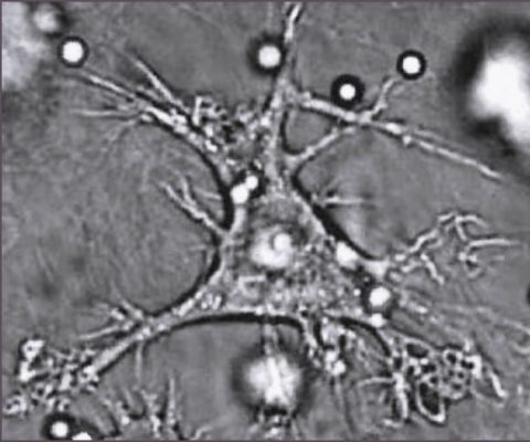 Photographie d'une cellule dendritique sous microscope. DR