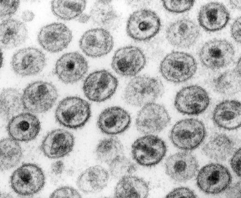 Le CEA-Leti annonce la mise au point d’une nouvelle approche vaccinale contre le virus du sida. VIH vus en microscopie électronique à transmission. DR