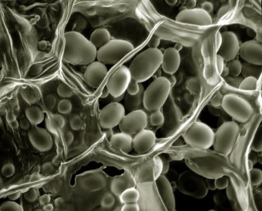 Grains d’amidon dans une cellule végétale observée au microscope. DR