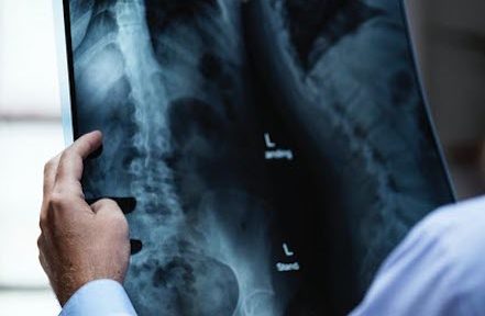 En Isère comme partout en France, les radiologues libéraux dénoncent le poids et la mainmise de tutelles déconnectées de la réalité dans la gestino de la crise sanitaire - DR