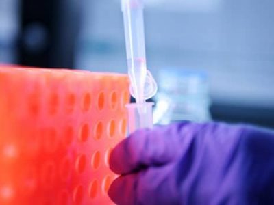 Nano-médicament, médecine de demain ?